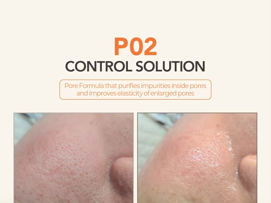 P02 Control Solution