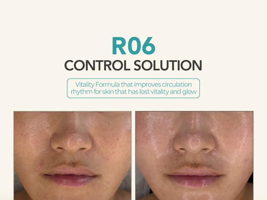 R06 Control Solution