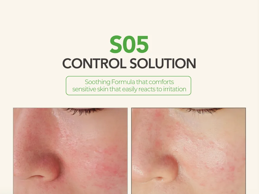 S05 Control Solution