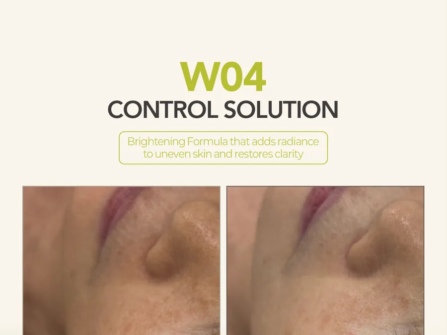 W04 Control Solution